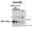 S6K1/2  | Ribosomal S6 kinase 1/2 